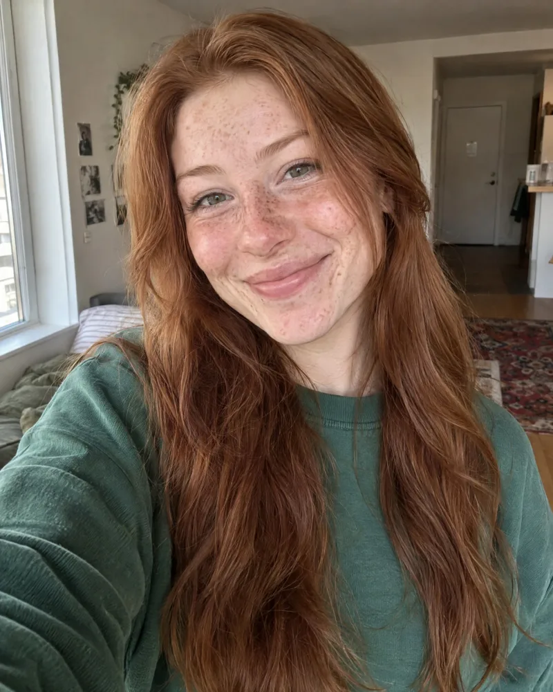 Freckles